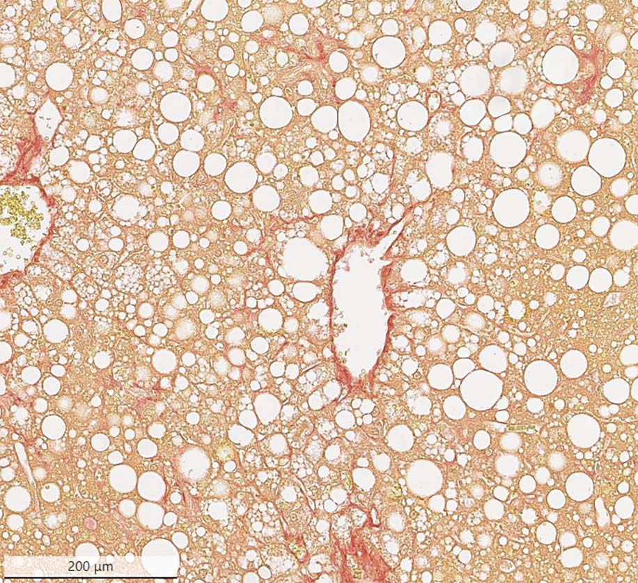 CCl4 Liver Fibrosis Model Ichor Life Sciences