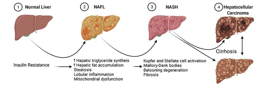 NASH Mouse Model | Ichor Life Sciences