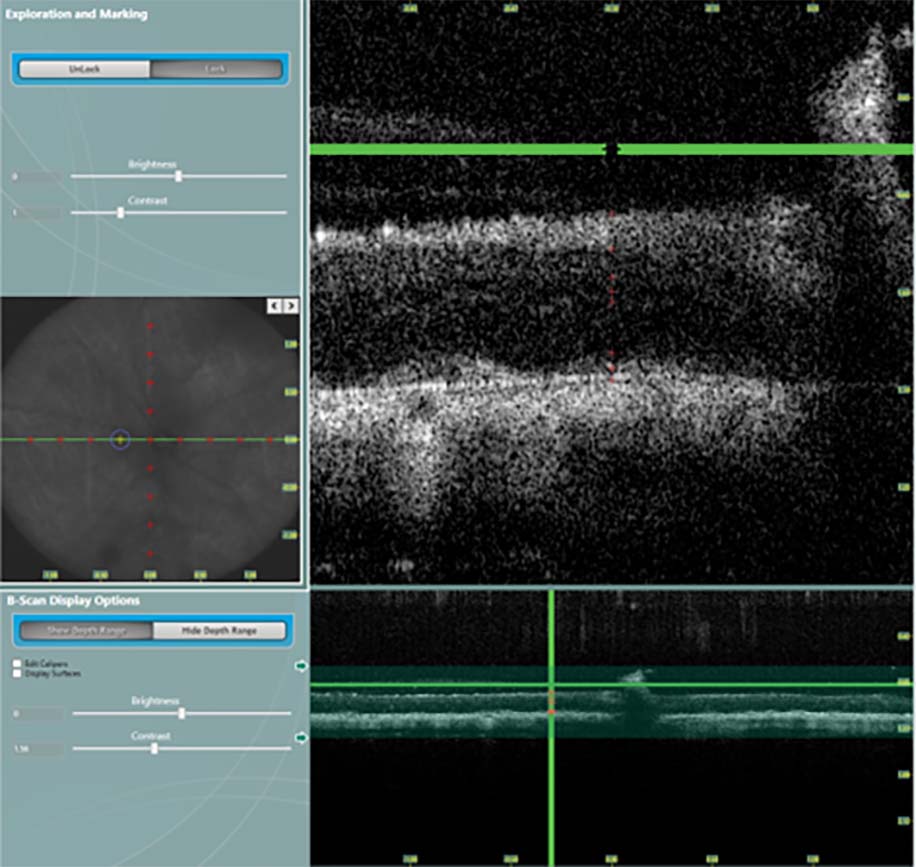 optic nerve experiment