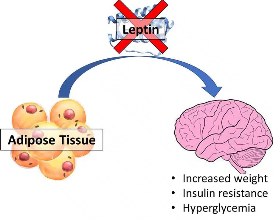 leptin-dysfunction