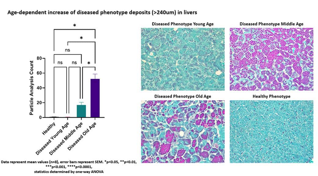 liver-quantification-data