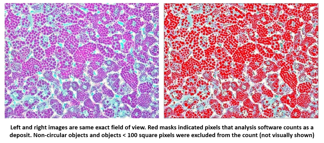 liver-quantification-masking