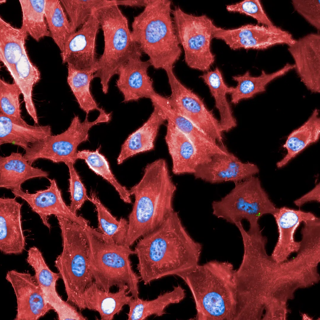 Figure 2 Red-Blue Cells