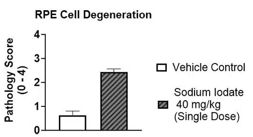 RPE-cell-degeneration-img