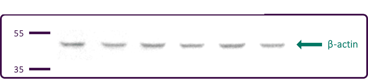 Western Blot