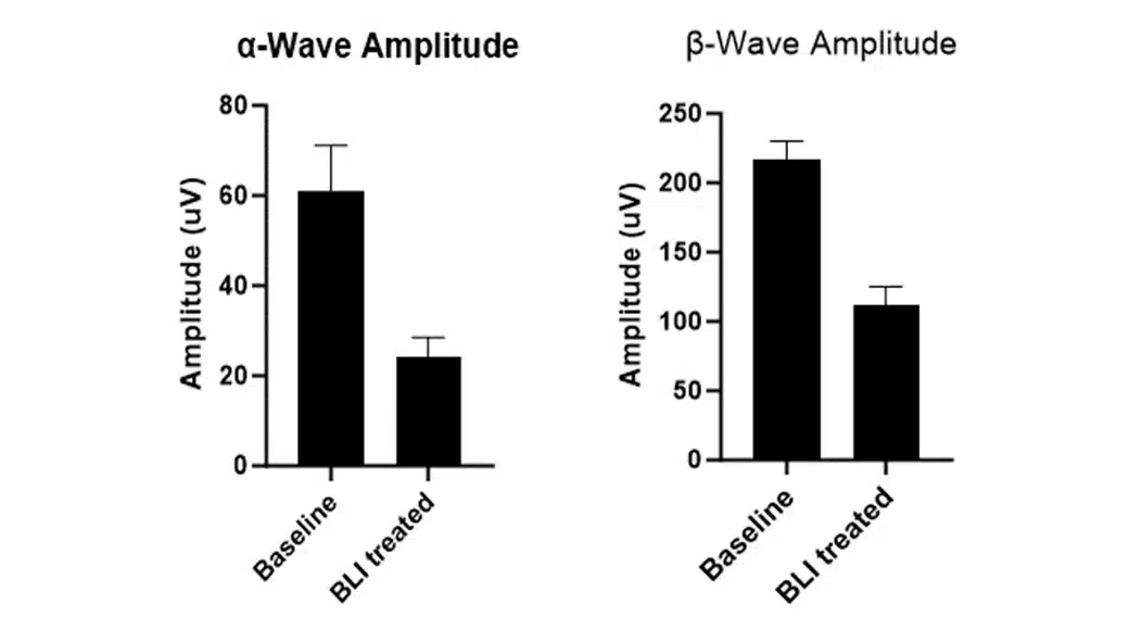 wave-amplitude